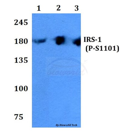 Anti-IRS-1 (phospho-S1101) Antibody from Bioworld Technology (BS4239) - Antibodies.com