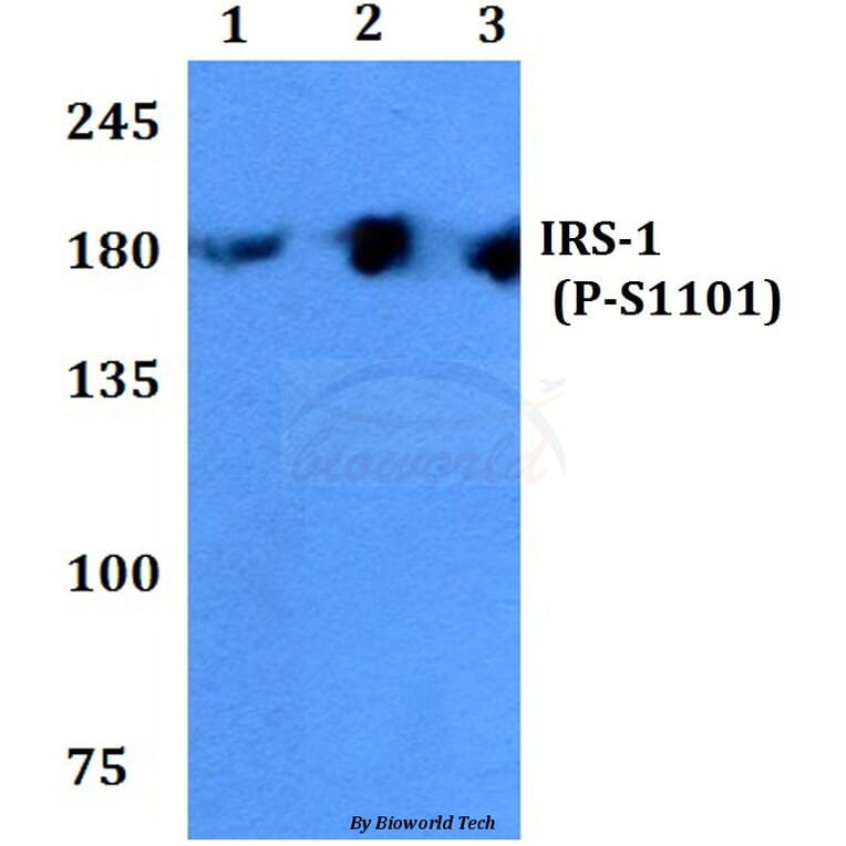 Anti-IRS-1 (phospho-S1101) Antibody from Bioworld Technology (BS4239) - Antibodies.com