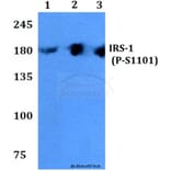 Anti-IRS-1 (phospho-S1101) Antibody from Bioworld Technology (BS4239) - Antibodies.com