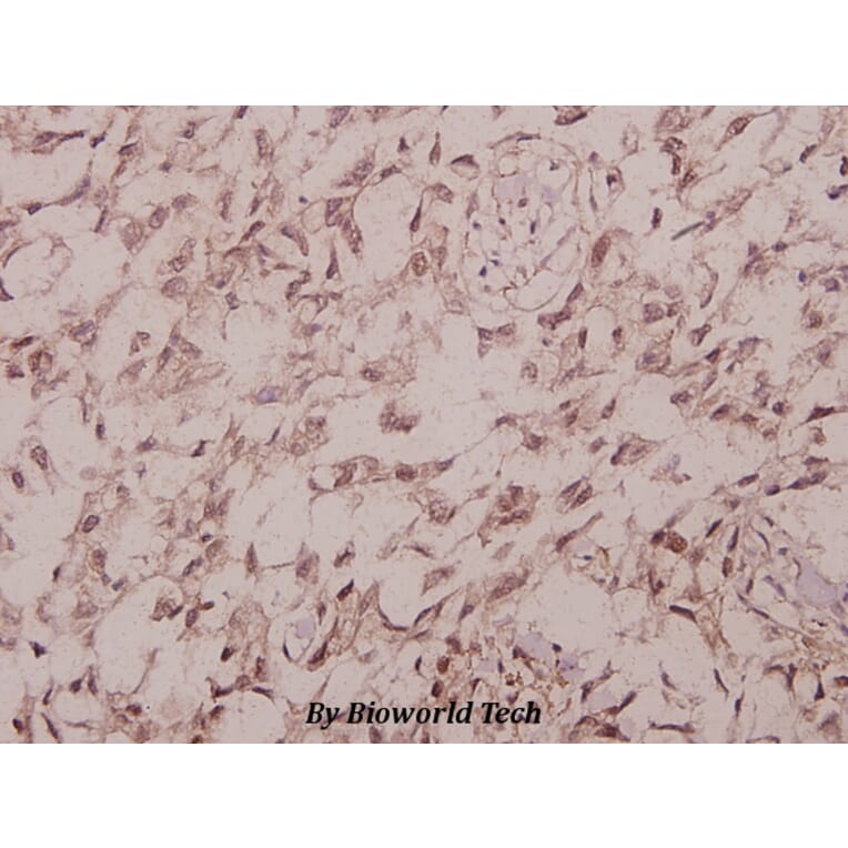 Anti-IRS-1 (phospho-S1101) Antibody from Bioworld Technology (BS4239) - Antibodies.com