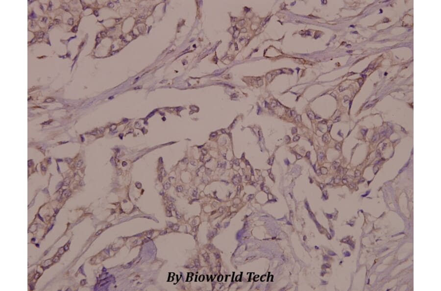 Anti-VE-Cadherin (phospho-Y731) Antibody from Bioworld Technology (BS4242) - Antibodies.com