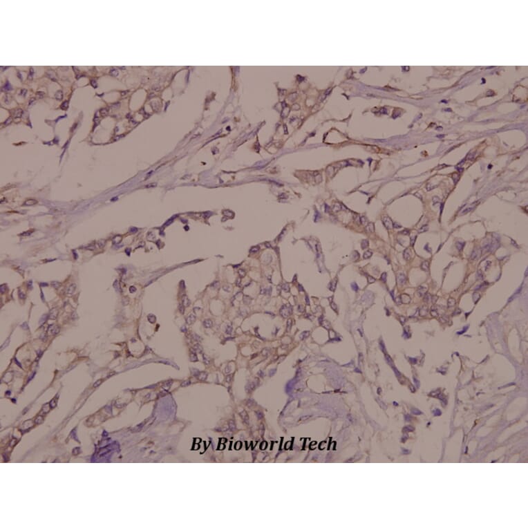 Anti-VE-Cadherin (phospho-Y731) Antibody from Bioworld Technology (BS4242) - Antibodies.com