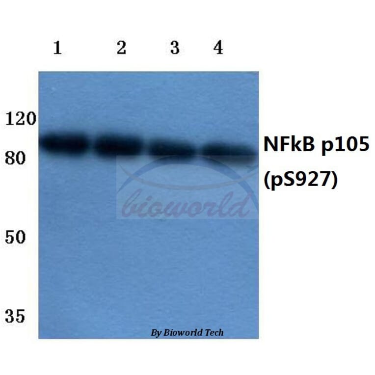 Anti-NFkB-p105 (phospho-S927) Antibody from Bioworld Technology (BS4243) - Antibodies.com