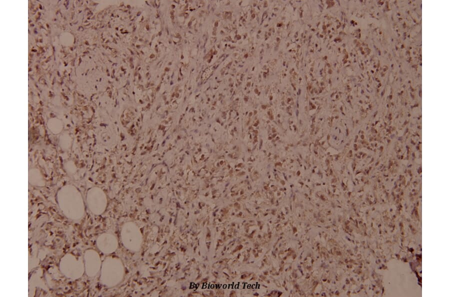 Anti-NFkB-p105 (phospho-S927) Antibody from Bioworld Technology (BS4243) - Antibodies.com
