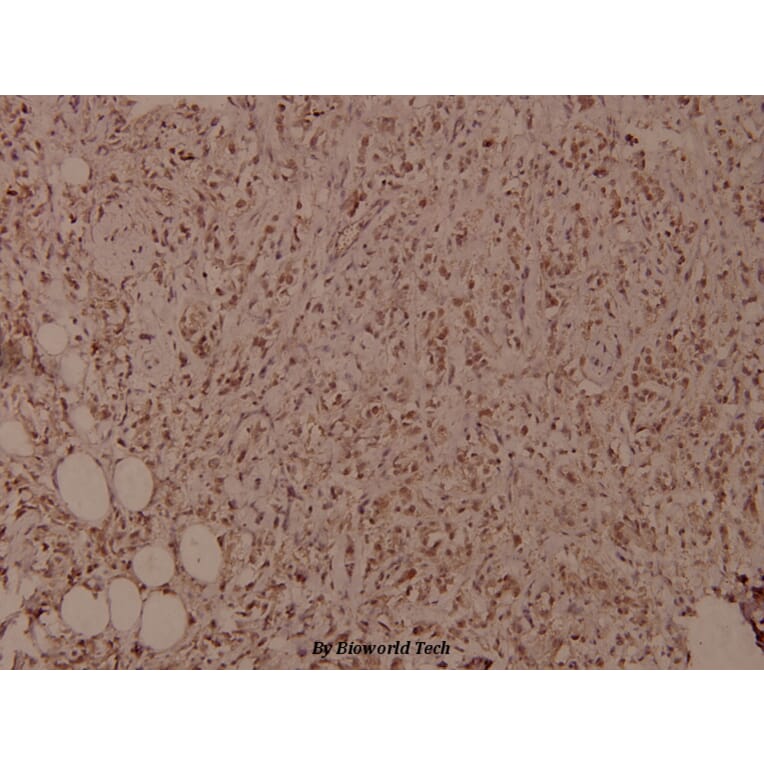 Anti-NFkB-p105 (phospho-S927) Antibody from Bioworld Technology (BS4243) - Antibodies.com