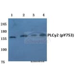 Anti-PLC γ2 (phospho-Y753) Antibody from Bioworld Technology (BS4245) - Antibodies.com