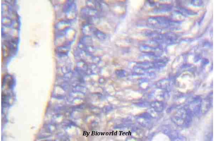 Anti-PLC γ2 (phospho-Y753) Antibody from Bioworld Technology (BS4245) - Antibodies.com