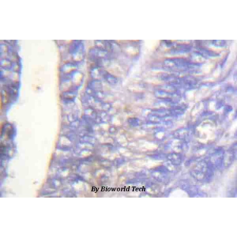 Anti-PLC γ2 (phospho-Y753) Antibody from Bioworld Technology (BS4245) - Antibodies.com