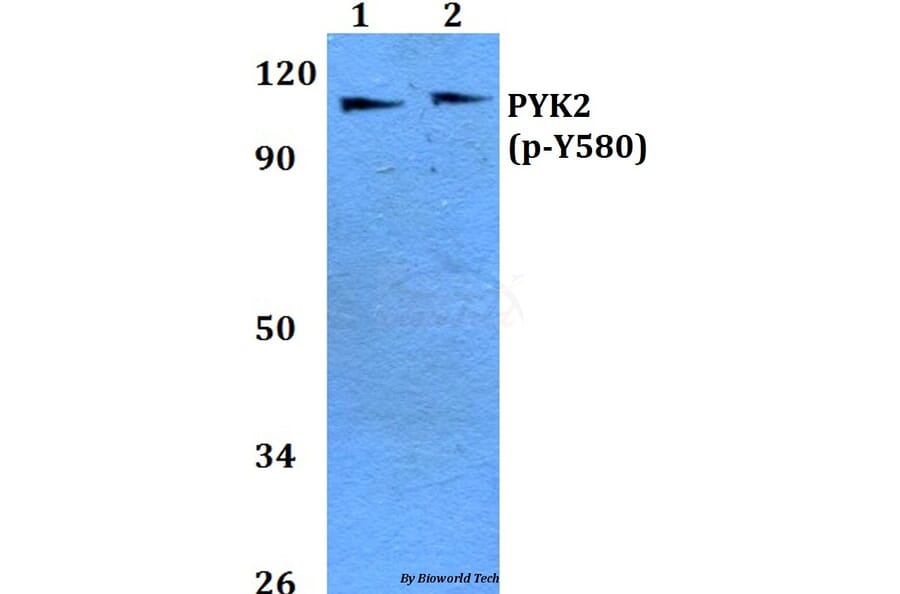 Anti-PYK2 (phospho-Y580) Antibody from Bioworld Technology (BS4247) - Antibodies.com