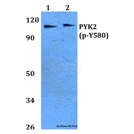 Anti-PYK2 (phospho-Y580) Antibody from Bioworld Technology (BS4247) - Antibodies.com