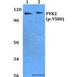 Anti-PYK2 (phospho-Y580) Antibody from Bioworld Technology (BS4247) - Antibodies.com