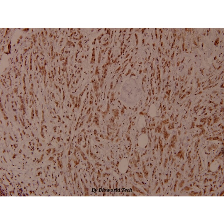 Anti-Shc (phospho-Y349) Antibody from Bioworld Technology (BS4250) - Antibodies.com