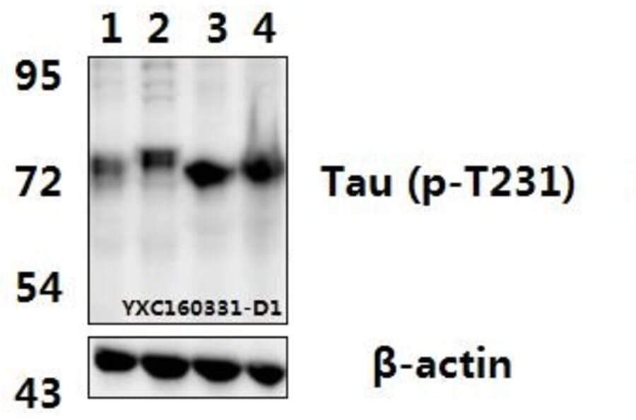 Anti-Tau (phospho-T231) Antibody from Bioworld Technology (BS4252) - Antibodies.com