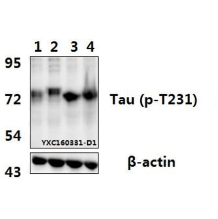 Anti-Tau (phospho-T231) Antibody from Bioworld Technology (BS4252) - Antibodies.com