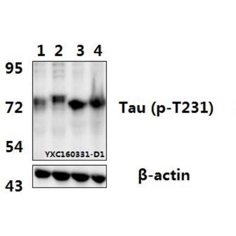 Anti-Tau (phospho-T231) Antibody from Bioworld Technology (BS4252) - Antibodies.com