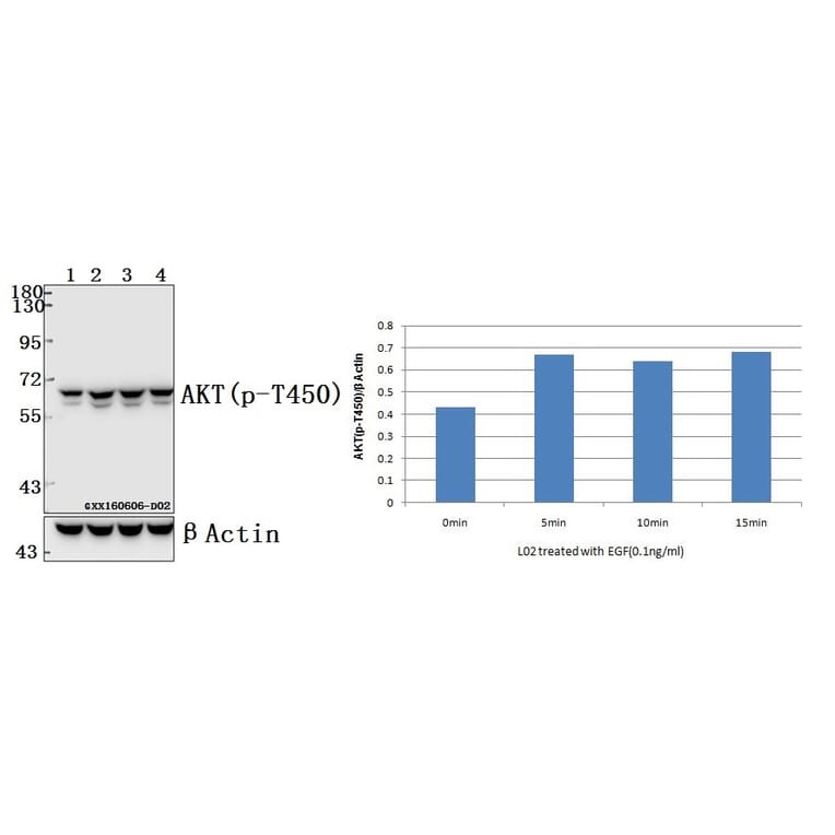 Anti-AKT (phospho-T450) Antibody from Bioworld Technology (BS4255) - Antibodies.com