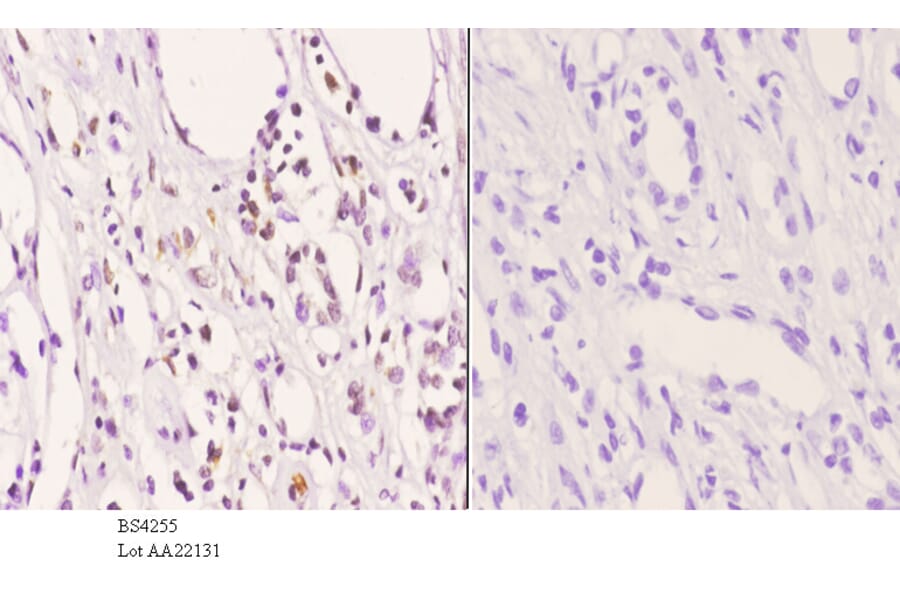 Anti-AKT (phospho-T450) Antibody from Bioworld Technology (BS4255) - Antibodies.com