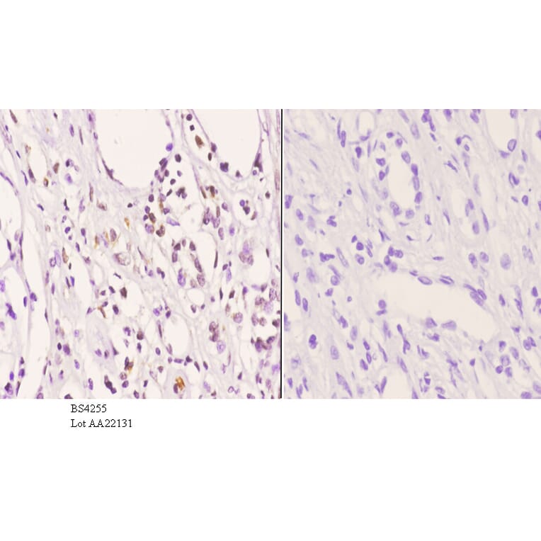 Anti-AKT (phospho-T450) Antibody from Bioworld Technology (BS4255) - Antibodies.com