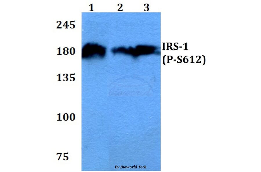 Anti-IRS-1 (phospho-S612) Antibody from Bioworld Technology (BS4257) - Antibodies.com