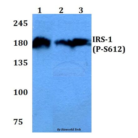 Anti-IRS-1 (phospho-S612) Antibody from Bioworld Technology (BS4257) - Antibodies.com