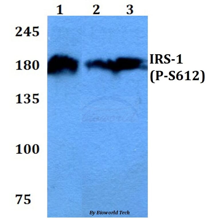 Anti-IRS-1 (phospho-S612) Antibody from Bioworld Technology (BS4257) - Antibodies.com