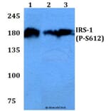 Anti-IRS-1 (phospho-S612) Antibody from Bioworld Technology (BS4257) - Antibodies.com