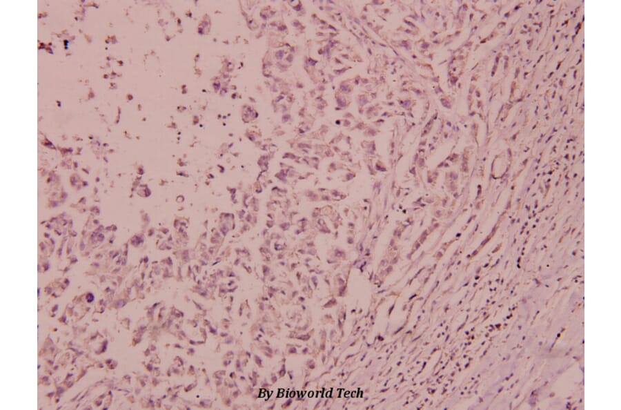 Anti-IRS-1 (phospho-S612) Antibody from Bioworld Technology (BS4257) - Antibodies.com