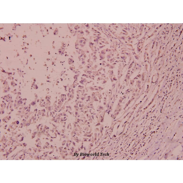 Anti-IRS-1 (phospho-S612) Antibody from Bioworld Technology (BS4257) - Antibodies.com