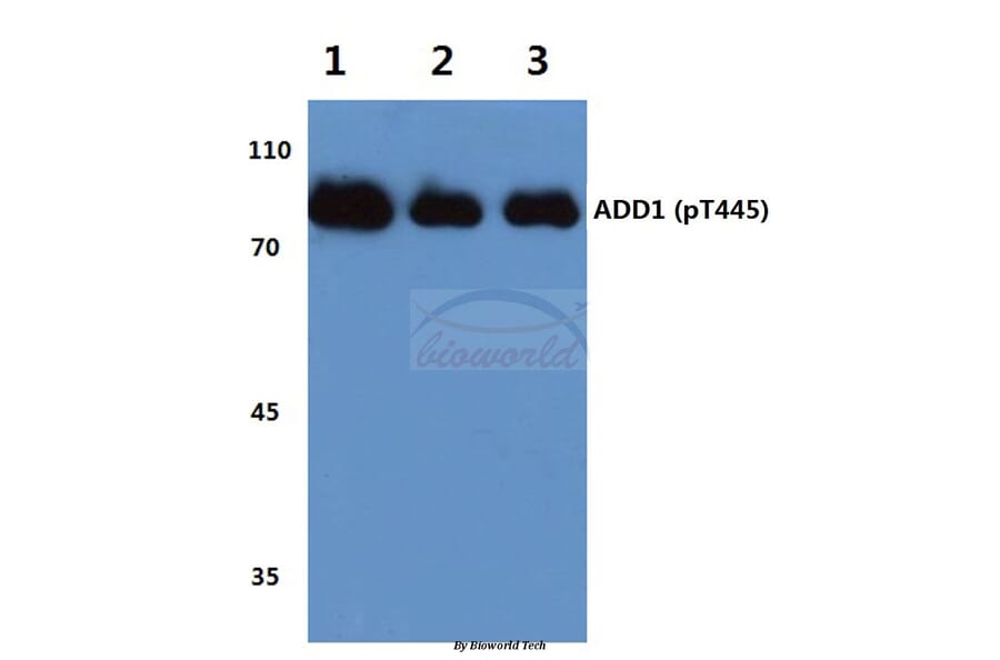 Anti-Adducin α (phospho-T445) Antibody from Bioworld Technology (BS4258) - Antibodies.com