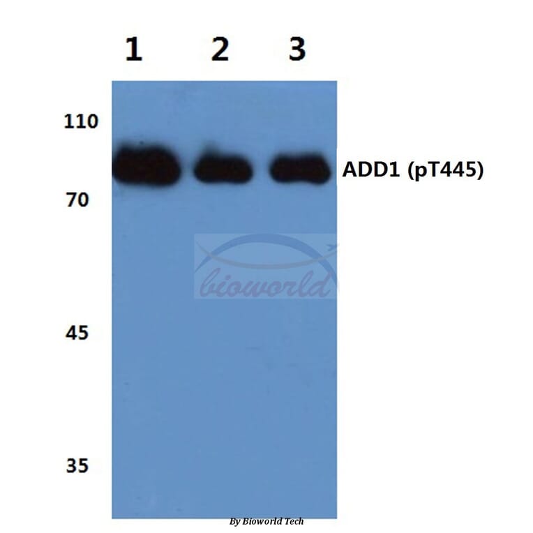 Anti-Adducin α (phospho-T445) Antibody from Bioworld Technology (BS4258) - Antibodies.com