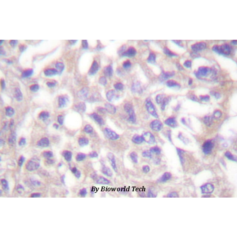 Anti-Adducin α (phospho-T445) Antibody from Bioworld Technology (BS4258) - Antibodies.com