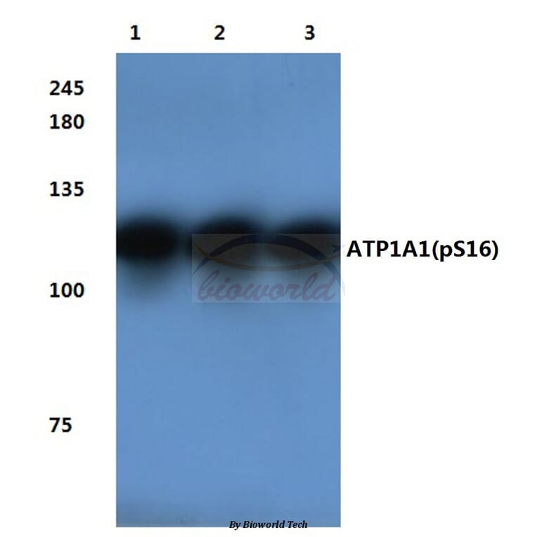 Anti-Na+/K+-ATPase α1 Antibody from Bioworld Technology (BS4259) - Antibodies.com