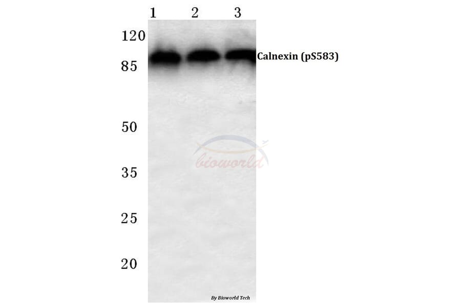 Anti-Calnexin (phospho-S583) Antibody from Bioworld Technology (BS4262) - Antibodies.com