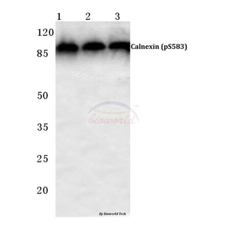 Anti-Calnexin (phospho-S583) Antibody from Bioworld Technology (BS4262) - Antibodies.com