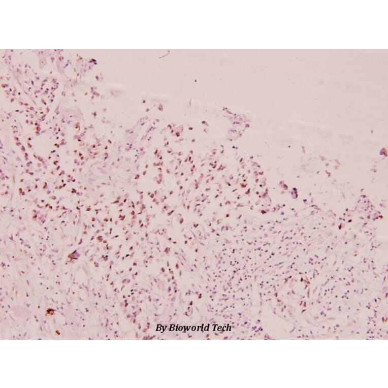 Anti-FoxO1/3/4 (phospho-T24/32) Antibody from Bioworld Technology (BS4266) - Antibodies.com