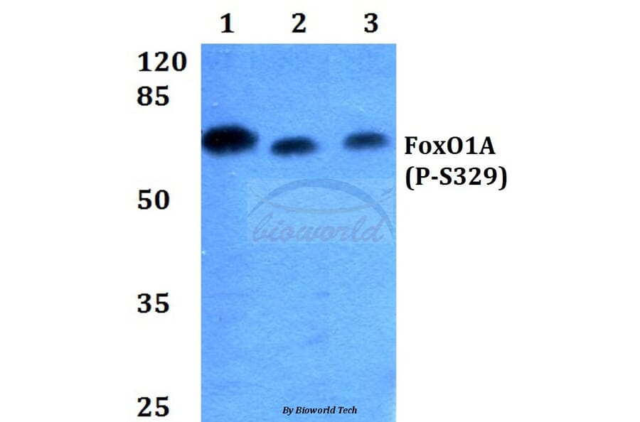 Anti-FKHR/FoxO1 (phospho-S329) Antibody from Bioworld Technology (BS4267) - Antibodies.com