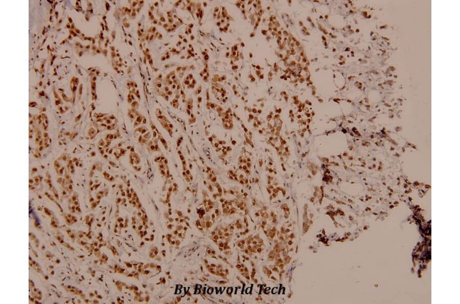 Anti-FKHR/FoxO1 (phospho-S329) Antibody from Bioworld Technology (BS4267) - Antibodies.com