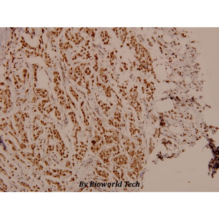 Anti-FKHR/FoxO1 (phospho-S329) Antibody from Bioworld Technology (BS4267) - Antibodies.com