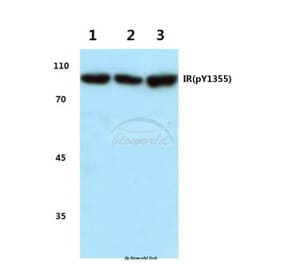 Anti-Insulin Receptor Antibody from Bioworld Technology (BS4270) - Antibodies.com