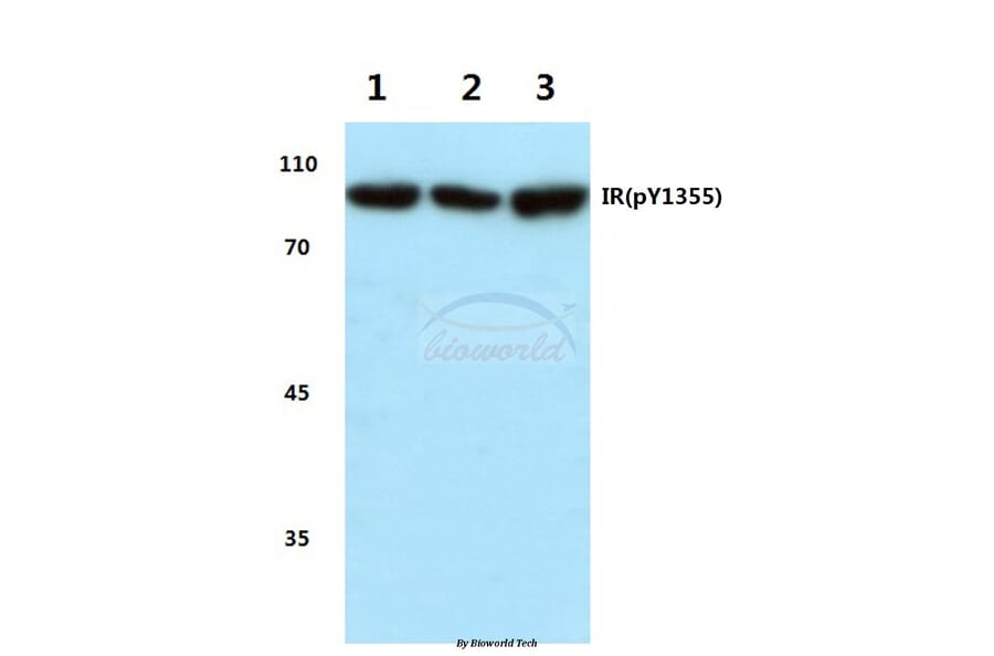 Anti-Insulin Receptor Antibody from Bioworld Technology (BS4270) - Antibodies.com