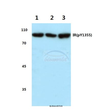 Anti-Insulin Receptor Antibody from Bioworld Technology (BS4270) - Antibodies.com