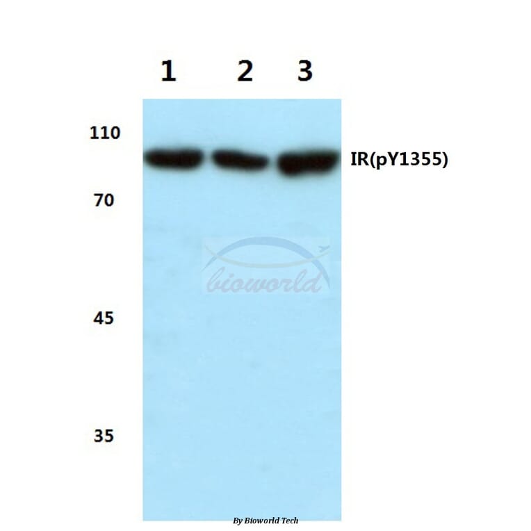 Anti-Insulin Receptor Antibody from Bioworld Technology (BS4270) - Antibodies.com