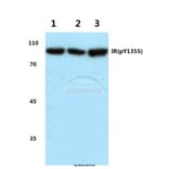 Anti-Insulin Receptor Antibody from Bioworld Technology (BS4270) - Antibodies.com