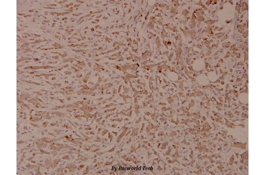 Anti-Insulin Receptor Antibody from Bioworld Technology (BS4270) - Antibodies.com