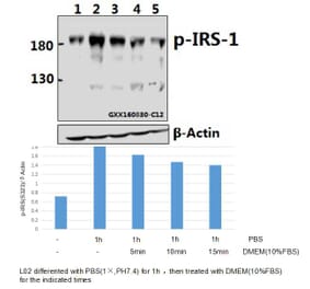 Anti-IRS-1 (phospho-S323) Antibody from Bioworld Technology (BS4271) - Antibodies.com
