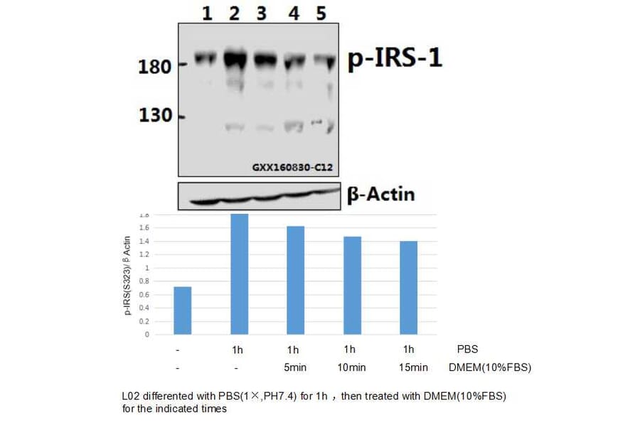 Anti-IRS-1 (phospho-S323) Antibody from Bioworld Technology (BS4271) - Antibodies.com