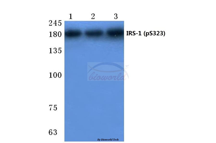 Anti-IRS-1 (phospho-S323) Antibody from Bioworld Technology (BS4271) - Antibodies.com