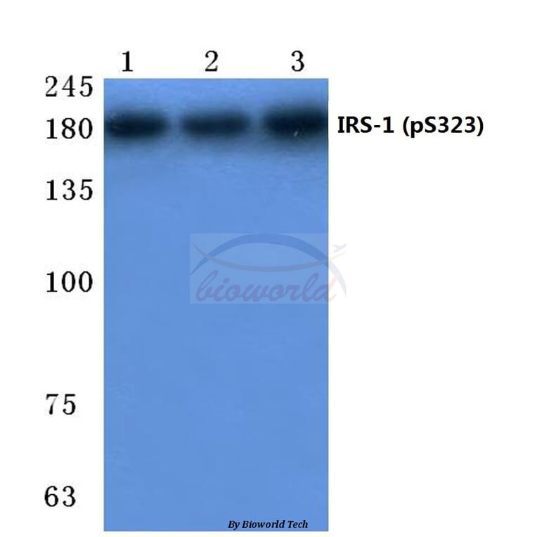 Anti-IRS-1 (phospho-S323) Antibody from Bioworld Technology (BS4271) - Antibodies.com