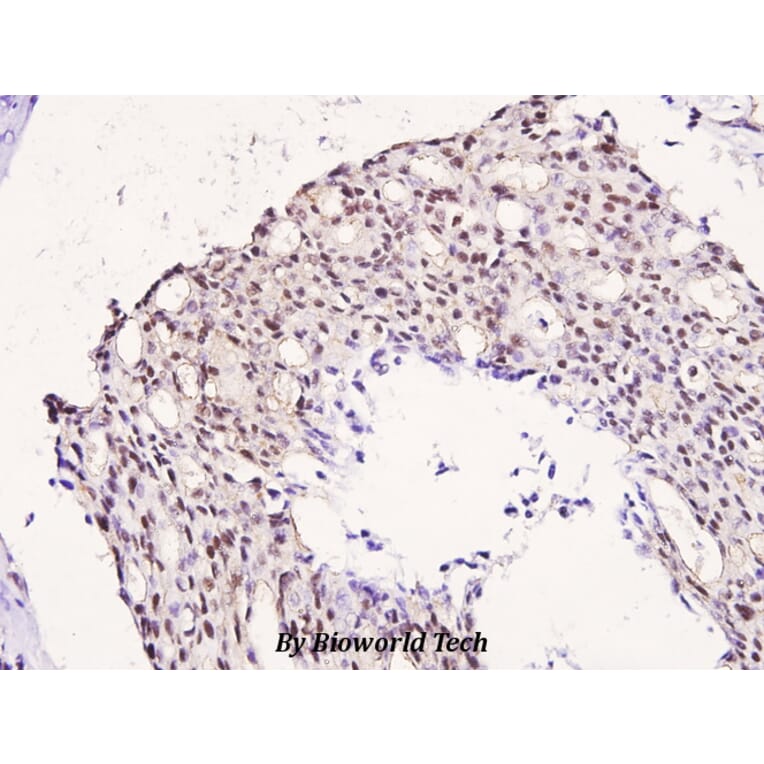Anti-IRS-1 (phospho-S323) Antibody from Bioworld Technology (BS4271) - Antibodies.com