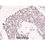 Anti-IRS-1 (phospho-S323) Antibody from Bioworld Technology (BS4271) - Antibodies.com